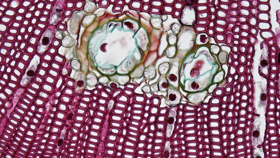 Muscle Tissue Study Guide Using Pattern Clues